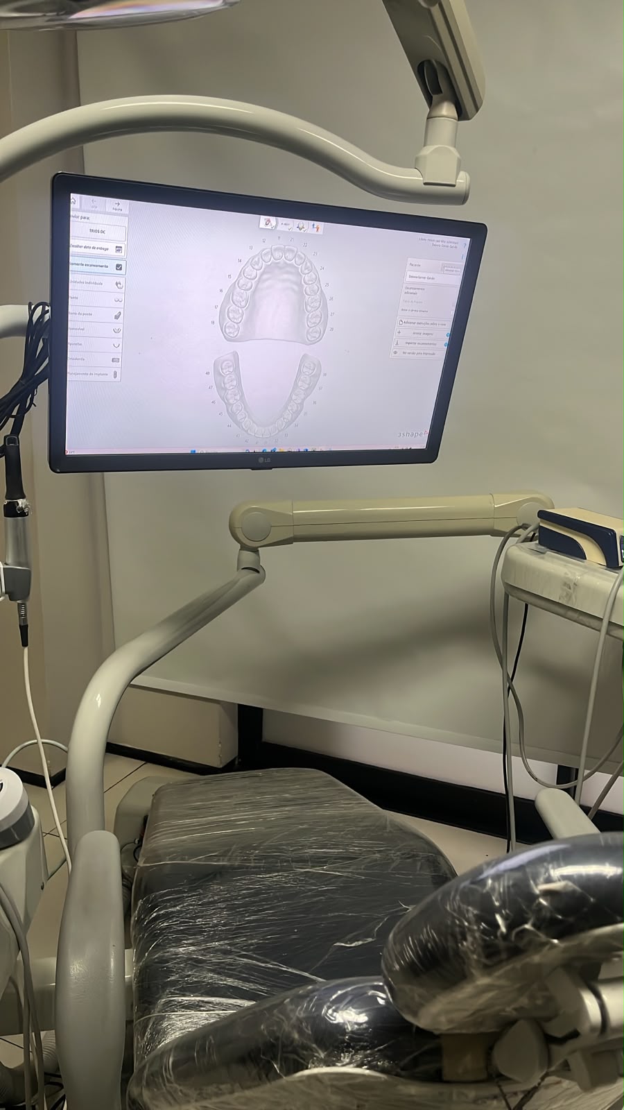Cadeira odontológica e monitor com modelo digital das arcadas dentárias no consultório da Odonto Said