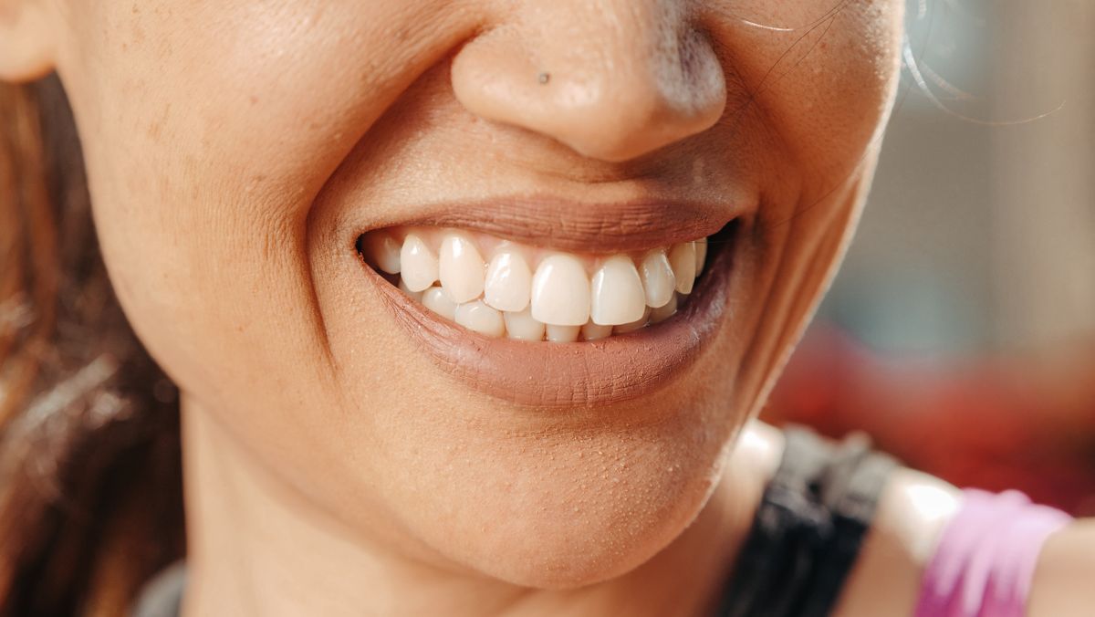 Detalhe de um sorriso natural, imagem ilustrativa de estética dental